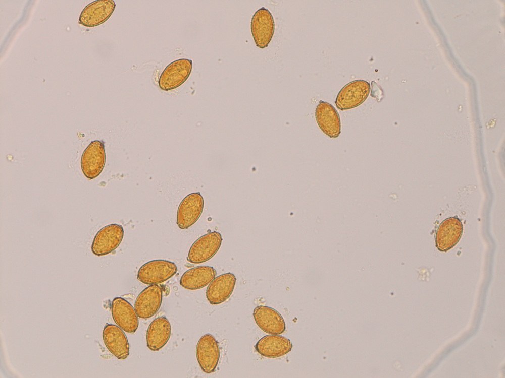 Liver fluke eggs seen under a microscope, yellow-brown football shaped eggs